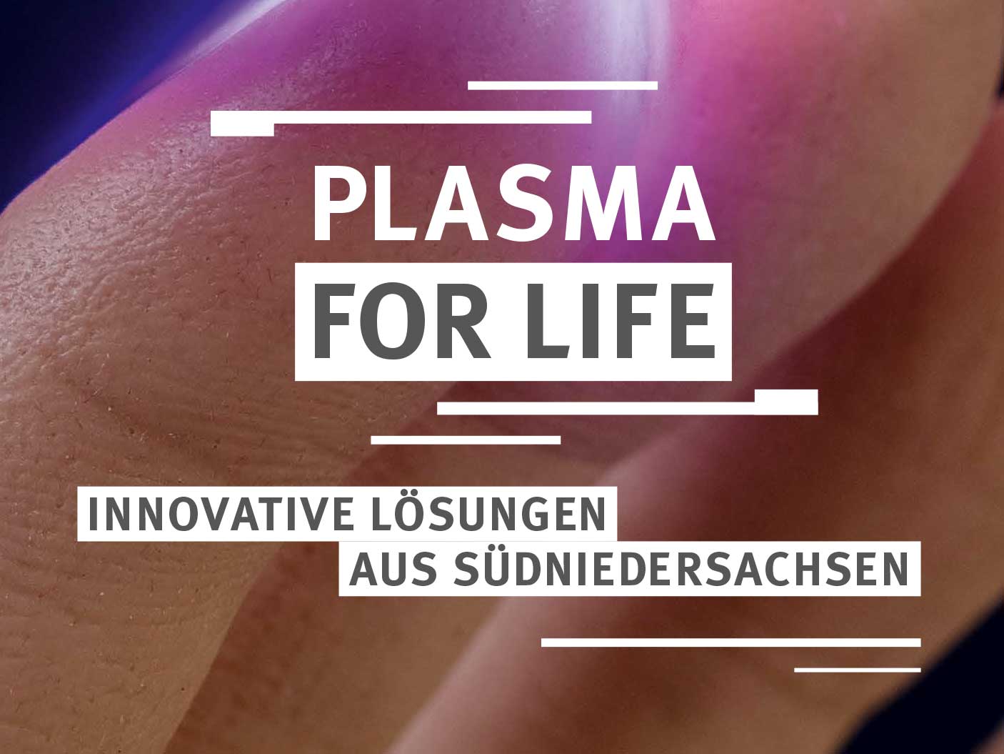 „Plasma for life“: Unternehmen für Kooperationen gesucht